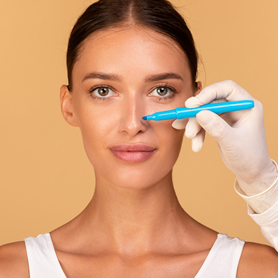 Rinoplastia