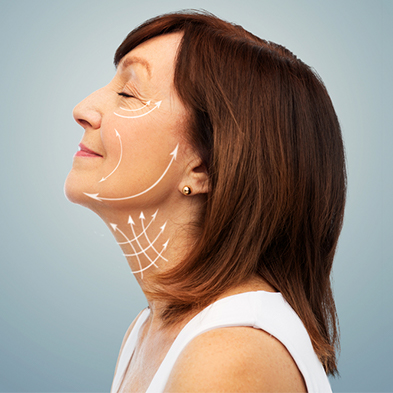 Ritidoplastia (rejuvenescimento facial)