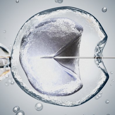 Injeção Intracitoplasmática de espermatozoides