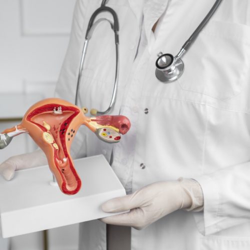 Fertilidade feminina: como planejar sua gravidez com SOP